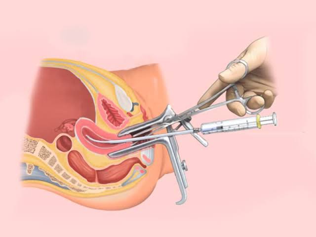 5 Drama Korea Tentang Inseminasi Buatan, Ada yang Berdasarkan Kisah Nyata Loh