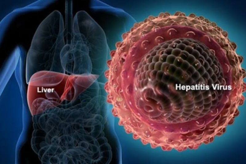 Dinkes Sidoarjo Bantah 3 Warganya Terjangkit Hepatitis Akut, Kadinkes: Hanya Hepatitis A Biasa