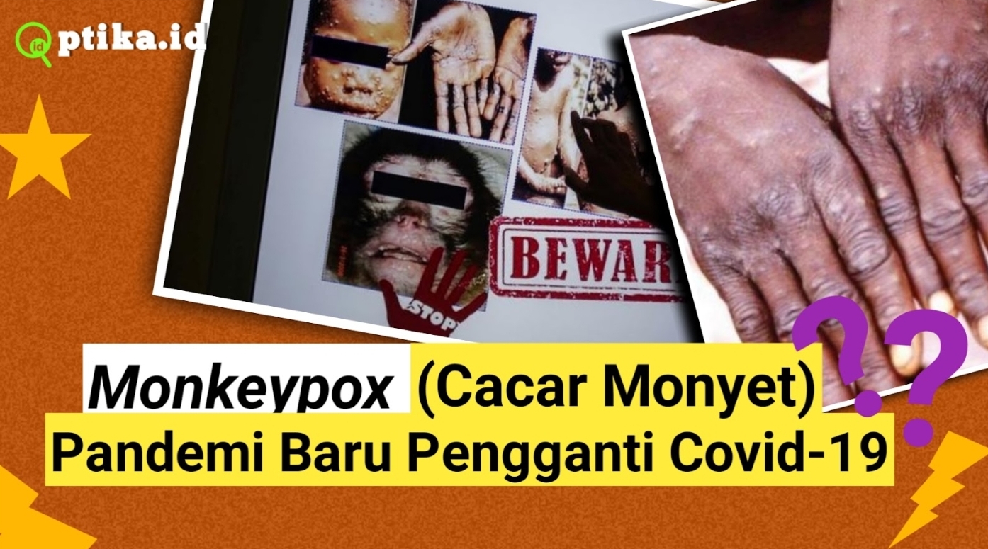 Muncul Penyakit Cacar Monyet, Indonesia Masih Belum Punya Vaksinnya? 