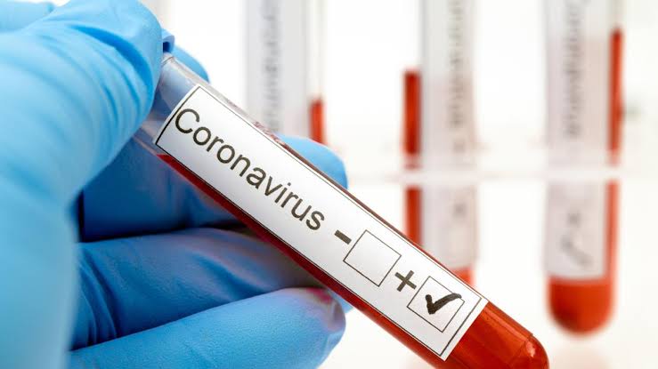 Khofifah: Terdapat 119 Kasus Covid-19 Baru dan 2 Virus Arcturus
