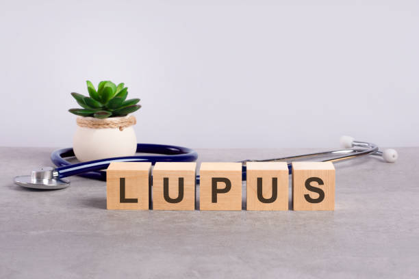 Lupus, Si Penyakit Seribu Wajah yang Berbahaya dan Sulit Terdeteksi