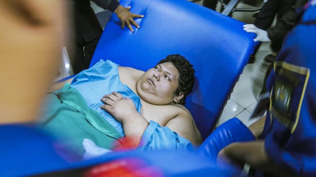 Berita Duka dari RSCM, Pemuda Obesitas 300 Kilogram Meninggal Dunia