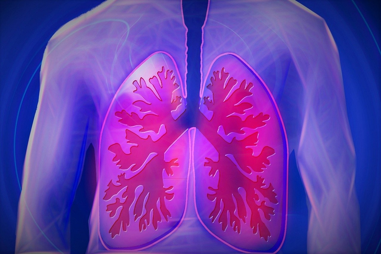 Lansia Berpotensi Terkena TBC Imbas Polusi Udara